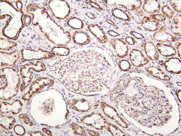 m03598 1 atp5a1 primary antibodies ihc testing 1