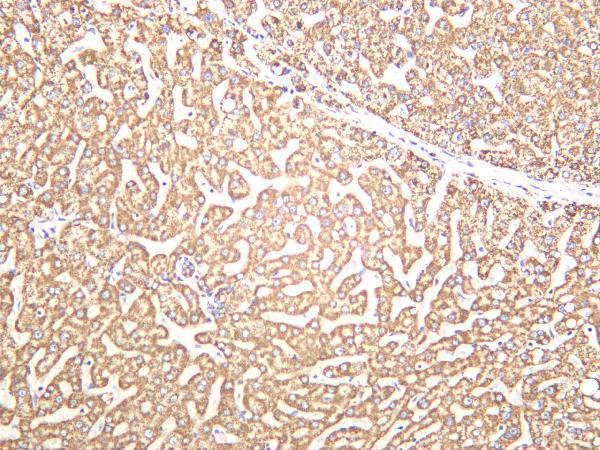 m03598 1 atp5a1 primary antibodies ihc testing 2