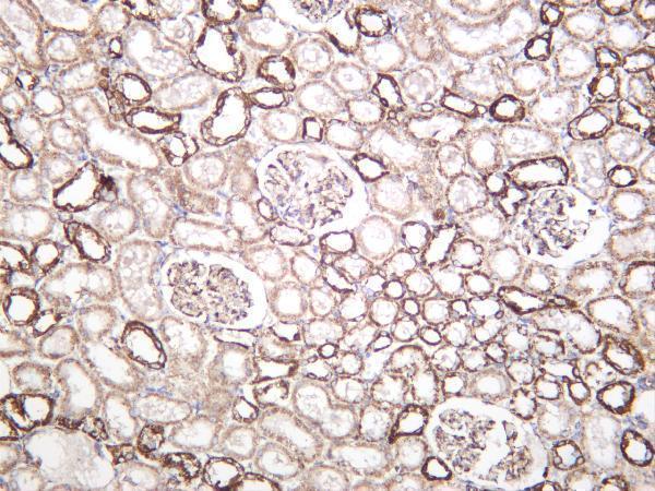 m03598 1 atp5a1 primary antibodies ihc testing 3