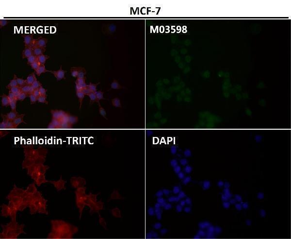 m03598 icc2