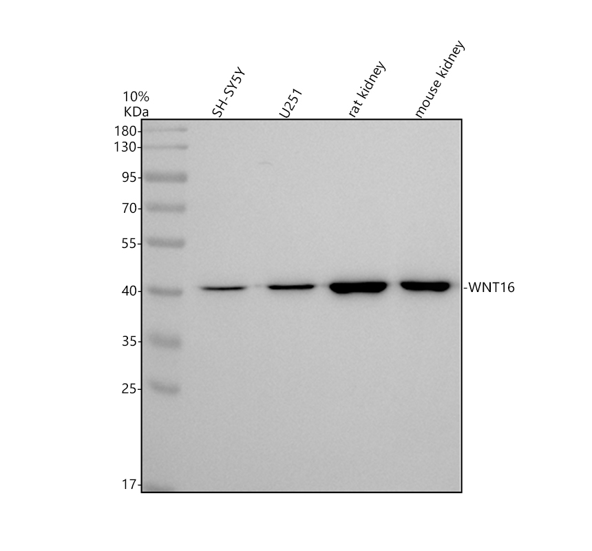 Western blot analysis of WNT16 using anti-WNT16 antibody (M03606)