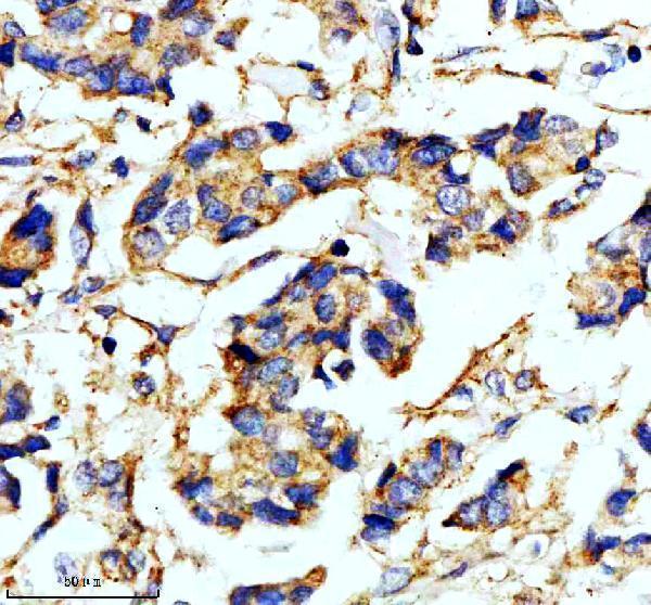 m03608 1 ndufs4 primary antibodies ihc testing 1_1