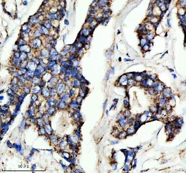 m03608 2 ndufs4 primary antibodies ihc testing 1