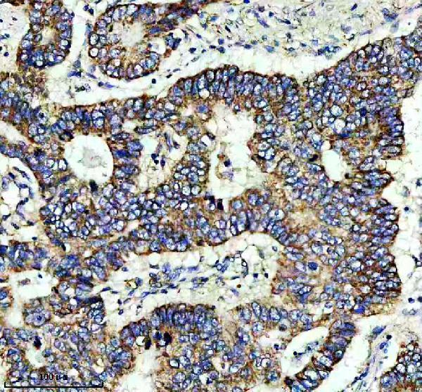 m03608 2 ndufs4 primary antibodies ihc testing 2_1