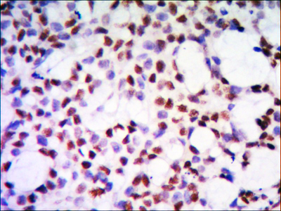 Immunohistochemistry validation of ANP32A using Anti-ANP32A Monoclonal Antibody (M03625)