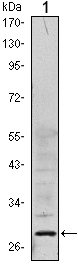 Western blotting validation for Anti-ANP32A Monoclonal Antibody M03625
Western Blot (WB) analysis using ANP32A Monoclonal Antibody against HeLa (1) cell lysate