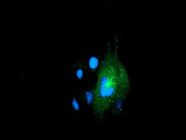m03628 anti lman1 mouse monoclonal antibody clone id oti1e3 if testing 14