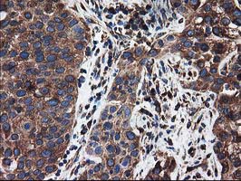 m03628 anti lman1 mouse monoclonal antibody clone id oti1e3 ihc testing 7