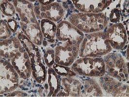 m03628 anti lman1 mouse monoclonal antibody clone id oti1e3 ihc testing 9