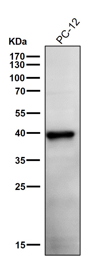 All lanes use the Antibody at 1:1K dilution for 1 hour at room temperature
