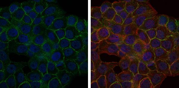 m03630 1 blnk primary antibodies if testing 4