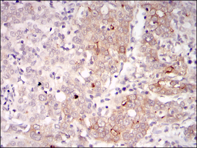 m03630 1 blnk primary antibodies ihc testing 3