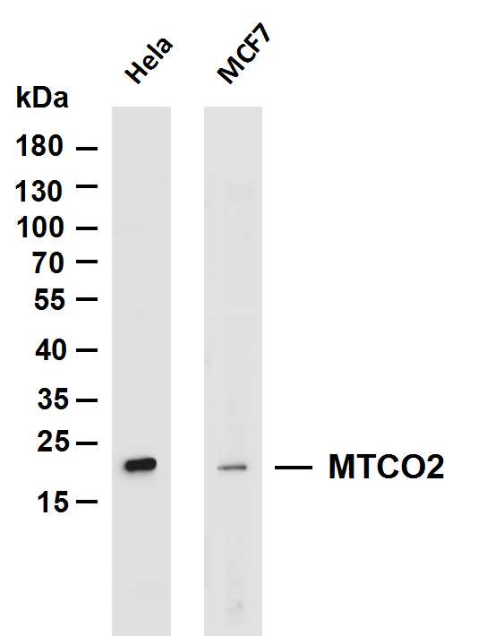 Various whole cell lysates were separated by 4-20% SDS-PAGE, and the membrane was blotted with anti-MTCO2 antibody