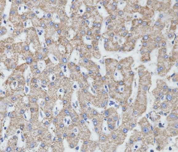 Immunohistochemical analysis of paraffin-embedded human liver, using MTCO2 Antibody