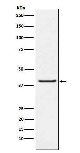 Western blot analysis of PAR4 expression in LnCaP cell lysate