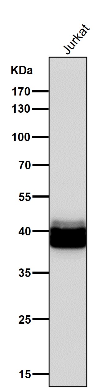 All lanes use the Antibody at 1:1K dilution for 1 hour at room temperature