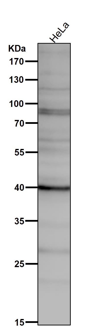 All lanes use the Antibody at 1:1K dilution for 1 hour at room temperature