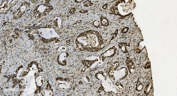 m03639 1 u2af2 primary antibodies ihc testing 11