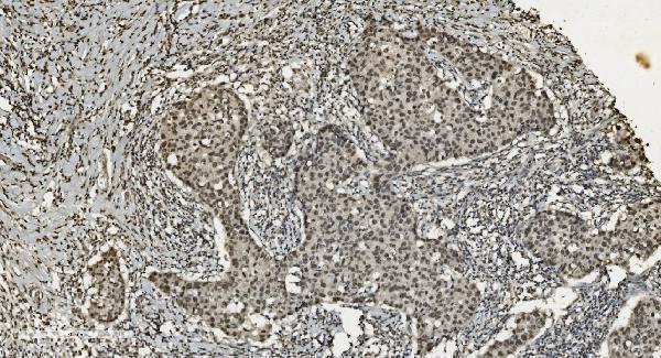 m03639 1 u2af2 primary antibodies ihc testing 3