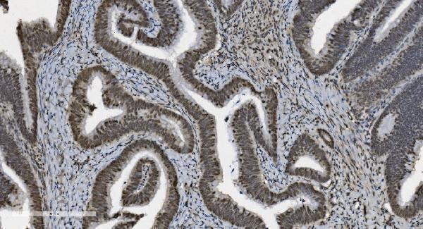 m03639 1 u2af2 primary antibodies ihc testing 4