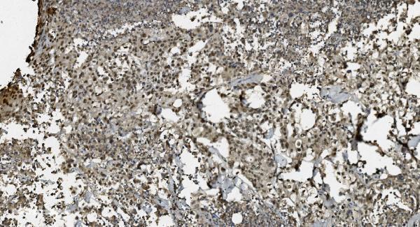 m03639 1 u2af2 primary antibodies ihc testing 5