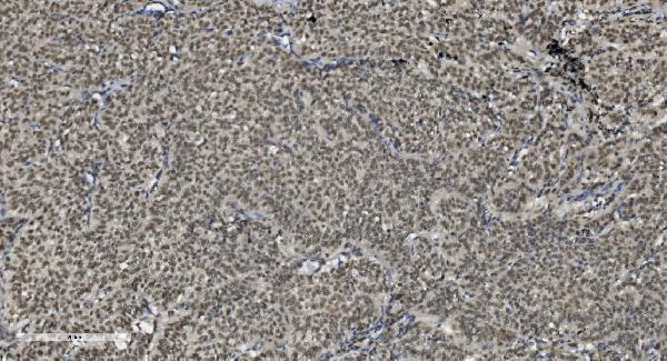 m03639 1 u2af2 primary antibodies ihc testing 6