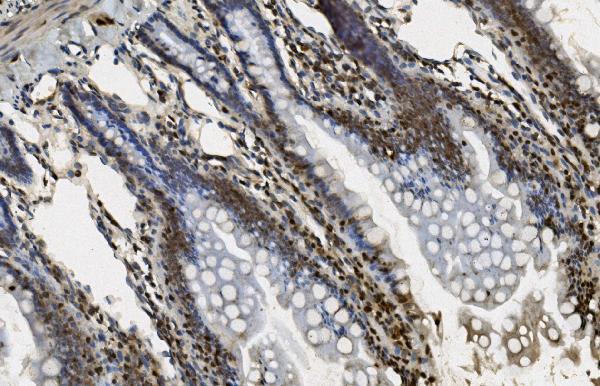 m03639 1 u2af2 primary antibodies ihc testing 8