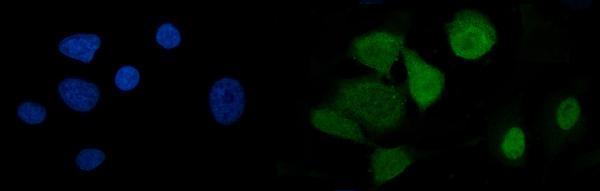 m03639 u2af2 primary antibodies if testing 9