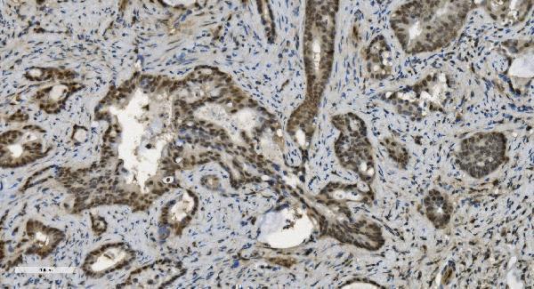 m03639 u2af2 primary antibodies ihc testing 2