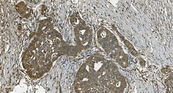 m03639 u2af2 primary antibodies ihc testing 3