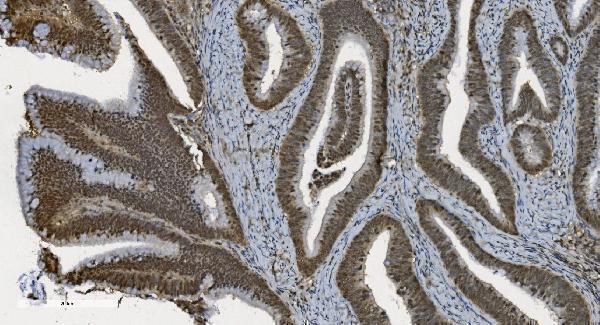m03639 u2af2 primary antibodies ihc testing 4