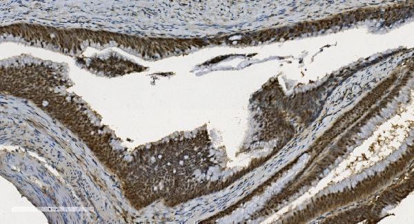 m03639 u2af2 primary antibodies ihc testing 5