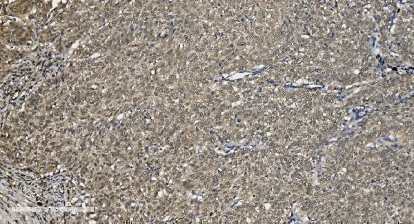 m03639 u2af2 primary antibodies ihc testing 6