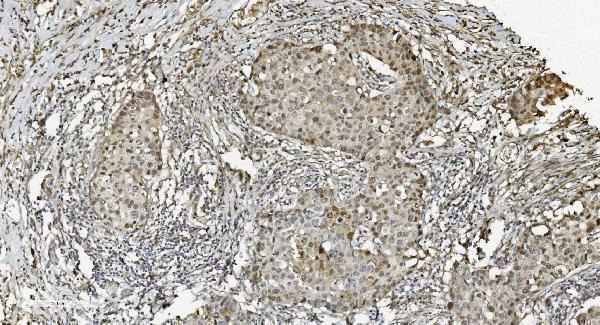 m03642 2 mcm5 primary antibodies ihc testing 4