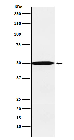 Western blot analysis of CYP26A1 expression in HepG2 cell lysate
