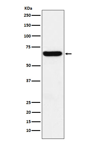 Western blot analysis of Methionine Aminopeptidase 2 expression in HeLa cell lysate