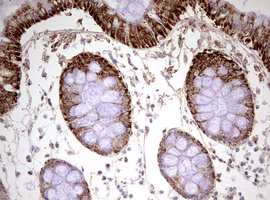 m03650 anti hadhsc hadh mouse monoclonal antibody clone id oti3d12 ihc testing 4