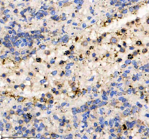 m03651 2 icam3 primary antibodies ihc testing 1