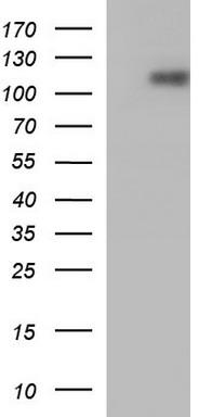 HEK293T cells were transfected with the pCMV6-ENTRY control (Left lane) or pCMV6-ENTRY ICAM3 (Right lane) cDNA for 48 hrs and lysed