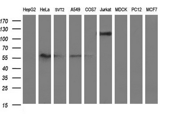 Western blot analysis of extracts (35ug) from 9 different cell lines by using anti-ICAM3 monoclonal antibody (HepG2: human; HeLa: human; SVT2: mouse; A549: human; COS7: monkey; Jurkat: human; MDCK: canine; PC12: rat; MCF7: human)