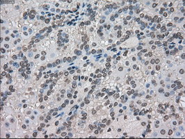 m03653 anti kindlin 2 fermt2 mouse monoclonal antibody clone id oti9e4 ihc testing 11