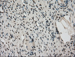 m03653 anti kindlin 2 fermt2 mouse monoclonal antibody clone id oti9e4 ihc testing 5