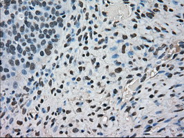 m03653 anti kindlin 2 fermt2 mouse monoclonal antibody clone id oti9e4 ihc testing 6