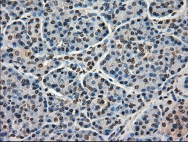 m03653 anti kindlin 2 fermt2 mouse monoclonal antibody clone id oti9e4 ihc testing 7