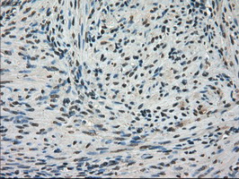 m03653 anti kindlin 2 fermt2 mouse monoclonal antibody clone id oti9e4 ihc testing 8