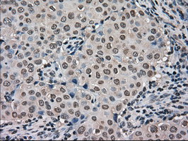 m03653 anti kindlin 2 fermt2 mouse monoclonal antibody clone id oti9e4 ihc testing 9