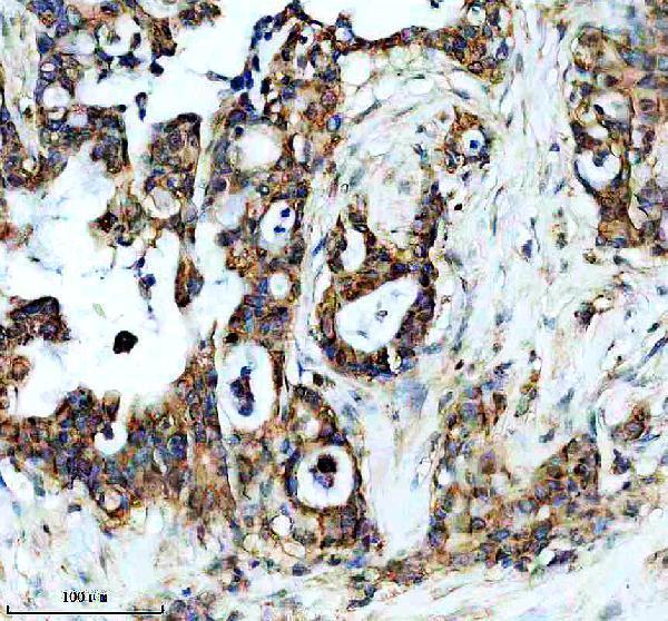 IHC analysis of GOPC using anti-GOPC antibody (M03660-1)