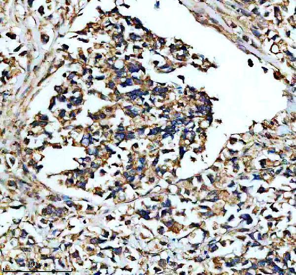 IHC analysis of GOPC using anti-GOPC antibody (M03660-1)