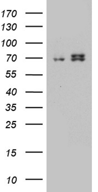 HEK293T cells were transfected with the pCMV6-ENTRY control (Left lane) or pCMV6-ENTRY HADHA (Right lane) cDNA for 48 hrs and lysed