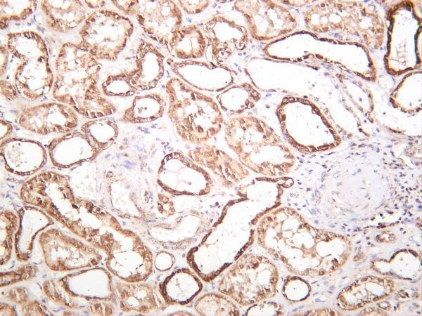 Human kidney was stained with anti-ACACB rabbit antibody